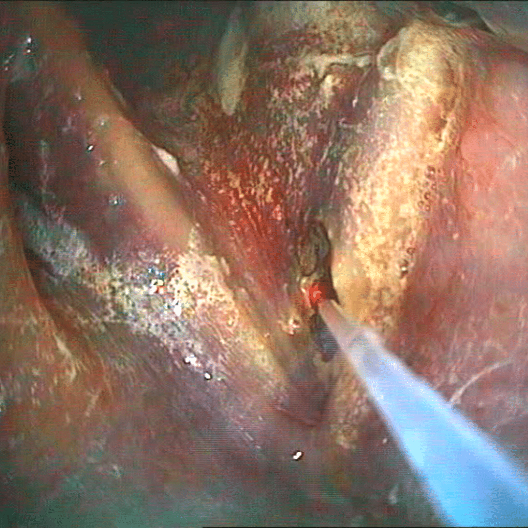 veterinary equine laser