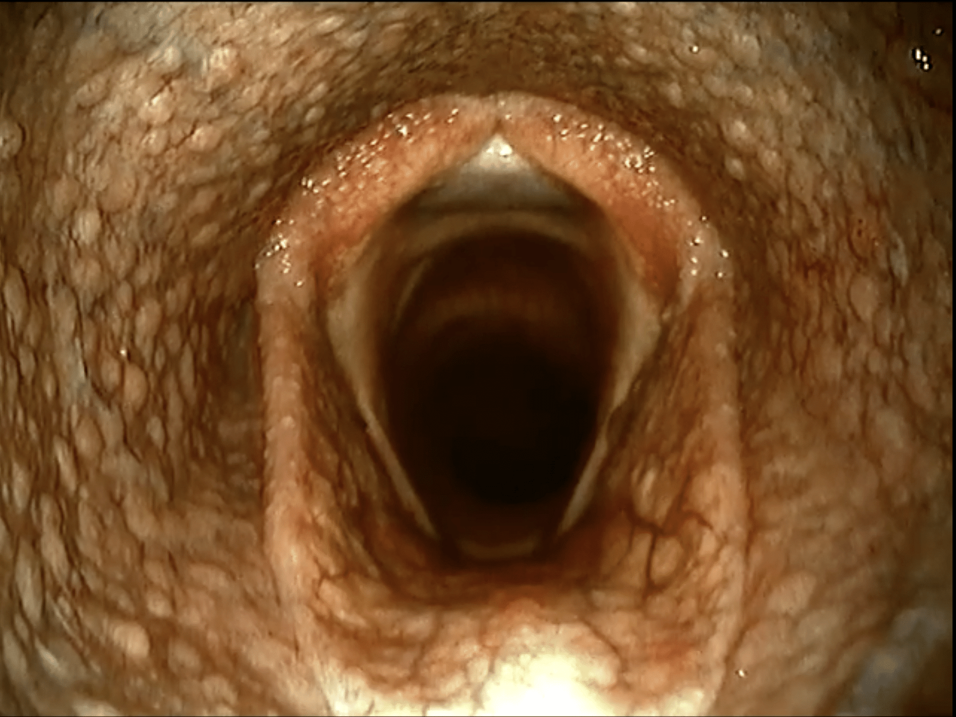 Equine airway scope video endoscope producing HD footage