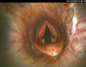 Equine airway scope for respiratory examinations with clear images