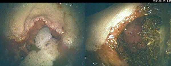 SPLIT SCREEN 2