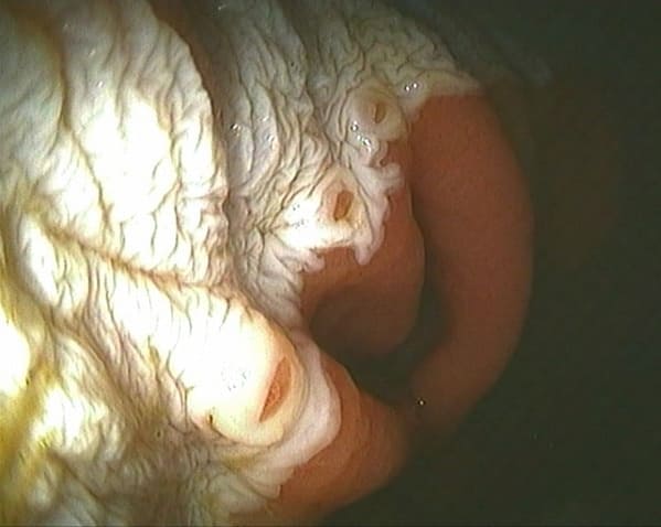 MARGO PLICATUS