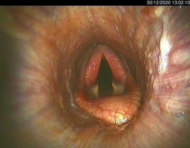 Equine airway scope for respiratory examinations with clear images